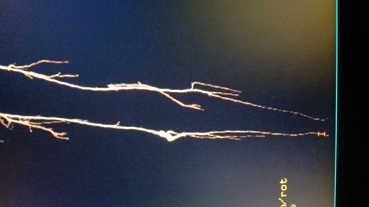 اعطيك معلومات مختصرة عن المرنان المغناطيسي