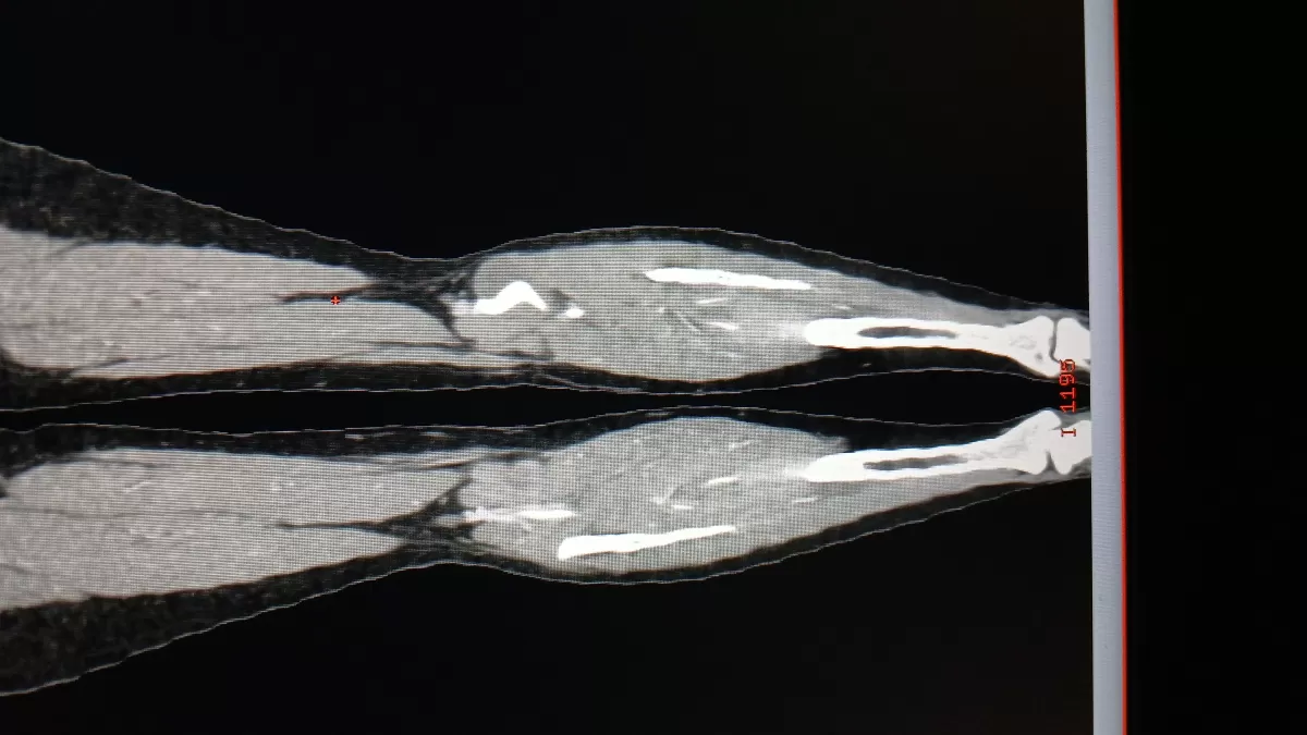 اعطيك معلومات مختصرة عن المرنان المغناطيسي