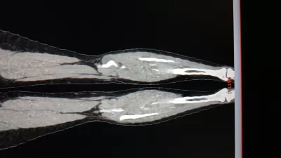 اعطيك معلومات مختصرة عن المرنان المغناطيسي