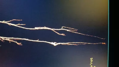 اعطيك معلومات مختصرة عن المرنان المغناطيسي